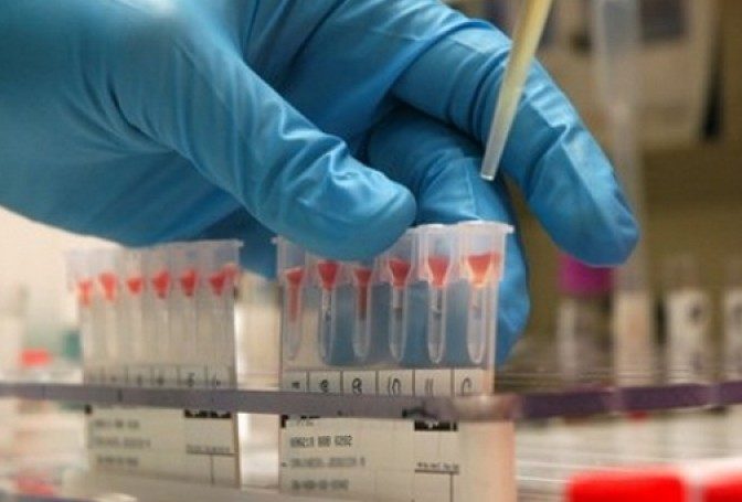 Sondaj APAH-RO: 70% dintre români nu s-au testat niciodată pentru depistarea hepatitei C