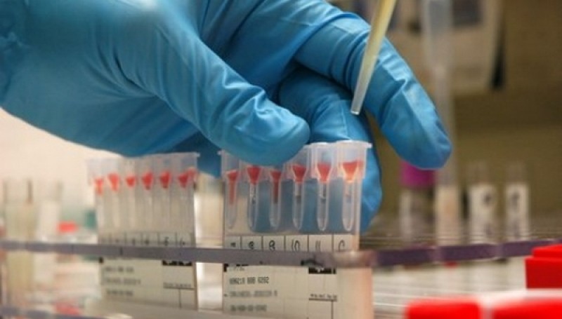 Sondaj APAH-RO: 70% dintre români nu s-au testat niciodată pentru depistarea hepatitei C