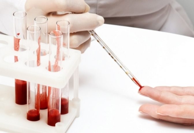 Preşedintele Societăţii Române de Microbiologie, Alexandru Rafila, recomandă vaccinul antigripal și în luna ianuarie