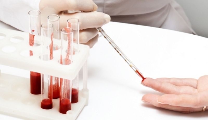 Preşedintele Societăţii Române de Microbiologie, Alexandru Rafila, recomandă vaccinul antigripal și în luna ianuarie