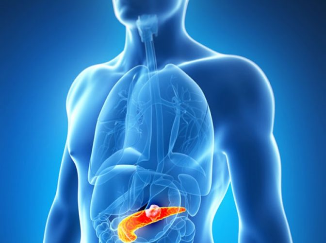 Pancreatita acută - Care sunt simptomele și riscurile