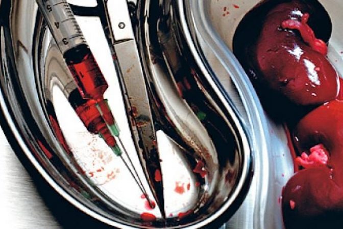 Prelevare de organe de la un donator din Botoşani aflat în moarte cerebrală care era internat Iași