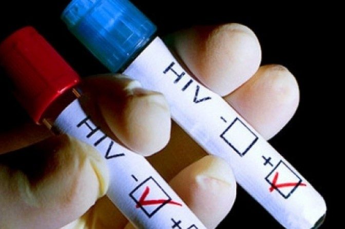 VICTORIE majoră a cercetătorilor: Virusul HIV, care declanşează SIDA, eliminat