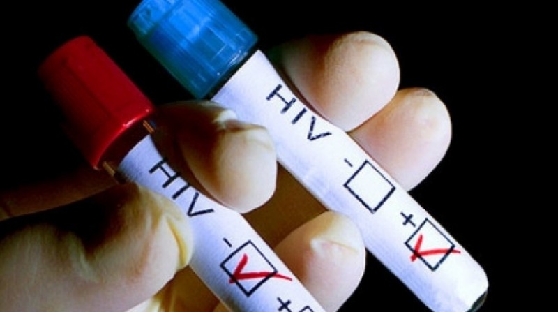 VICTORIE majoră a cercetătorilor: Virusul HIV, care declanşează SIDA, eliminat
