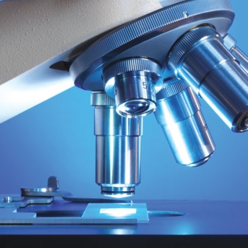 O bacterie ce produce alcool în intestine, răspunzătoare de boala ficatului gras la persoane care nu consumă alcool (studiu)