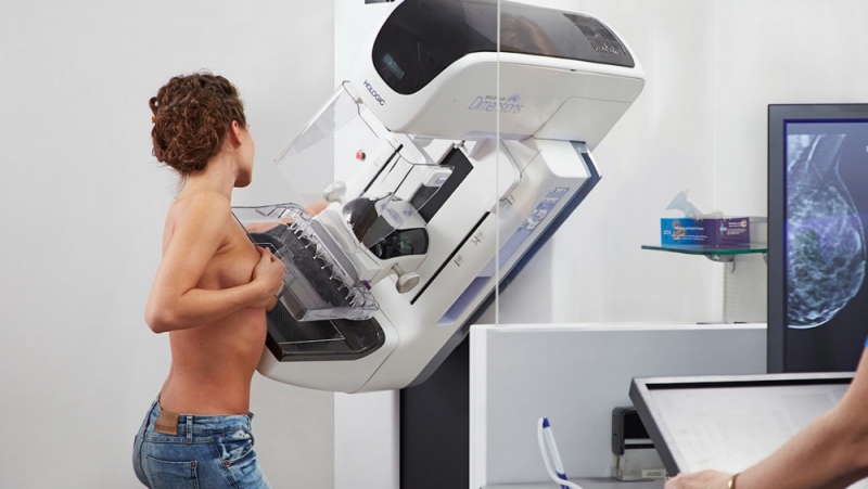 Imunoterapia poate reduce riscul de recidivă în cazul cancerului mamar triplu negativ (studiu)