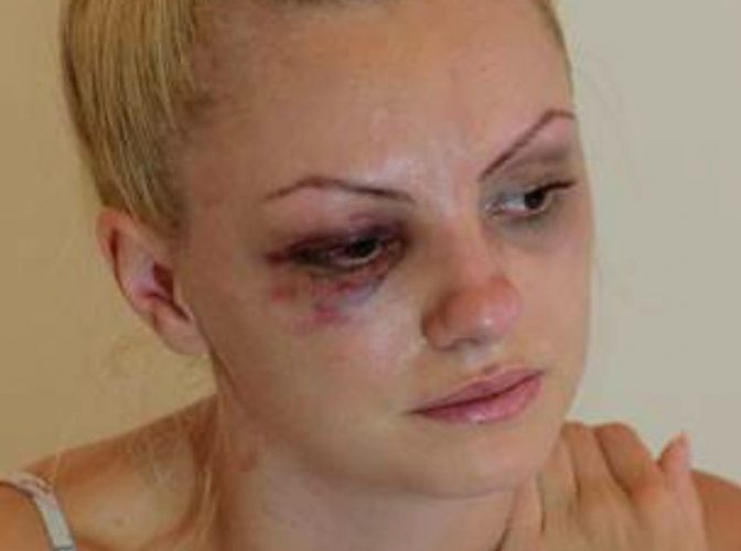 Cântăreaţa Alexandra Stan mai are şi acum coşmaruri cu bătaia cruntă încasată de la fostul impresar! Şocant ce pedeapsă a primit agresorul după ce a călcat-o în picioare