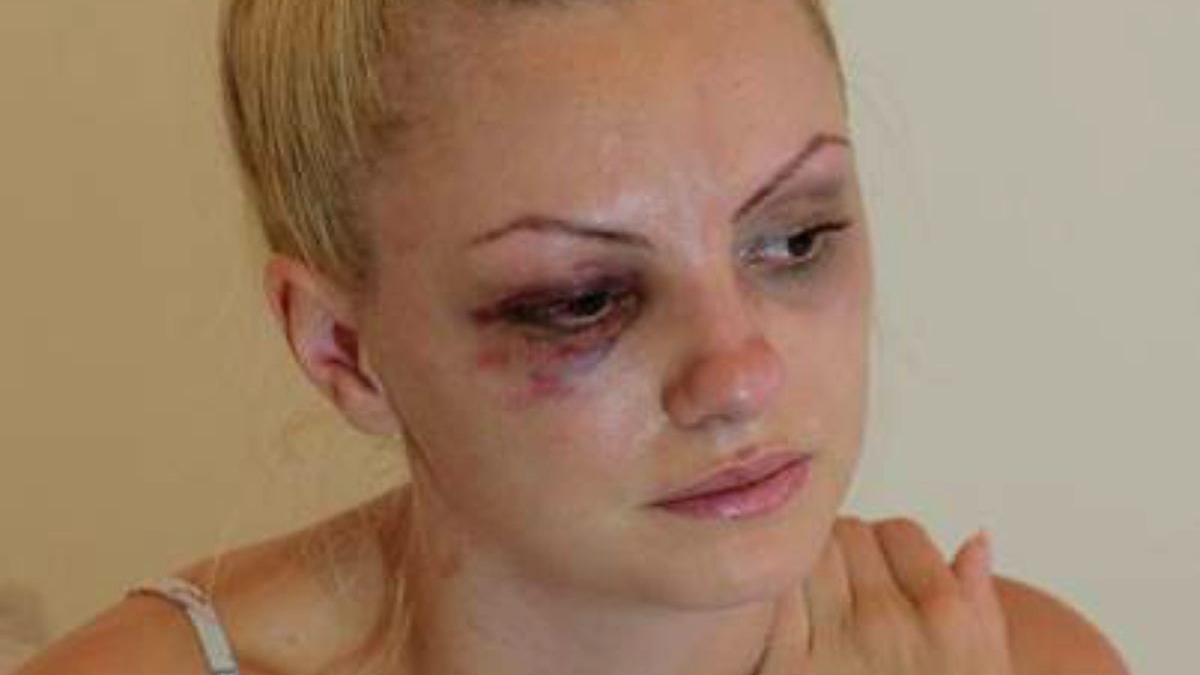 Cântăreaţa Alexandra Stan mai are şi acum coşmaruri cu bătaia cruntă încasată de la fostul impresar! Şocant ce pedeapsă a primit agresorul după ce a călcat-o în picioare