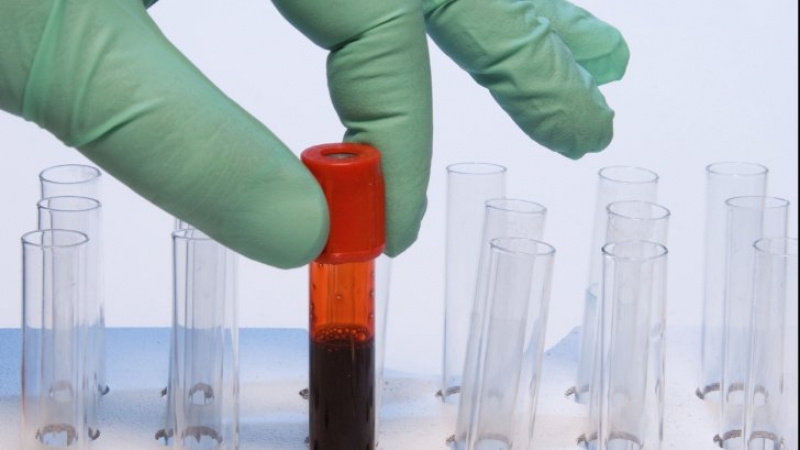 Președinte ARPID, Otilia Stanga: 'Consumul de imunoglobulină crește cu aproximativ 8-10% în fiecare an'