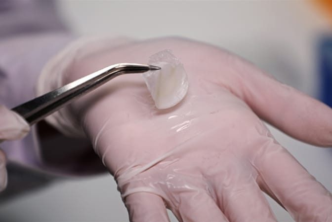 Progres URIAȘ - Cercetători din Singapore au reuşit să producă piele umană in-vitro