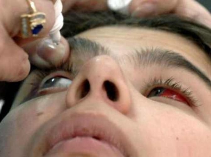 România pe ultimele locuri în UE la operaţiile de cataractă dar pe primele la naşterile prin cezariană