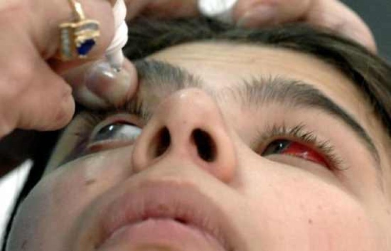 România pe ultimele locuri în UE la operaţiile de cataractă dar pe primele la naşterile prin cezariană