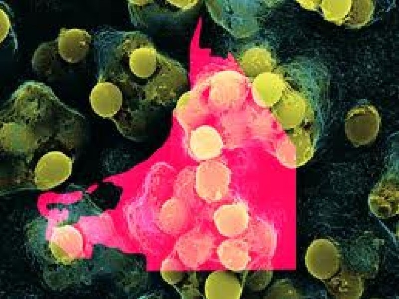 Avertismentul specialiștilor: Chiuveta din bucătărie este principala sursă de bacterii periculoase dintr-o locuinţă