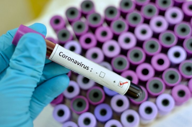 DETALIU capital remarcat de cercetători în lupta cu noul CORONAVIRUS. 41% dintre primii 138 de pacienţi diagnosticaţi au fost infectați chiar în SPITAL