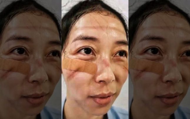 Faţa nevăzută a luptei cu virusul din China: medicii au
răni pe mâini şi pe faţă, poartă scutece şi dorm pe unde apucă