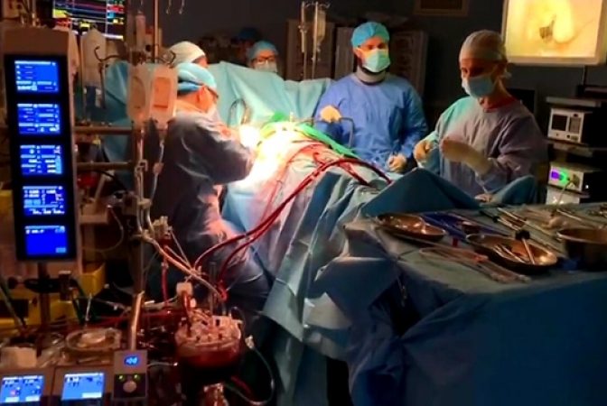 Pacienti cu boli cardiace, operati prin incizii de doar 3 cm de echipa medicala condusa de Conf Dr. Catalin Constantin Badiu