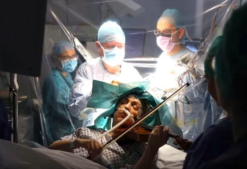 VIDEO O violonistă a ținut un recital în timp ce era operată pe creier