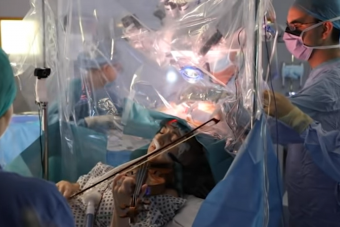 VIDEO Gest incredibil făcut de o femeie -  a cântat la vioară în timp ce medicii o operau pe creier