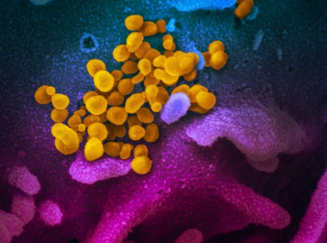 Dezvăluiri șocante ale cercetătorilor din Milano: 'Versiunea italiană' a noului coronavirus 'circula neobservată de câteva săptămâni' în Italia